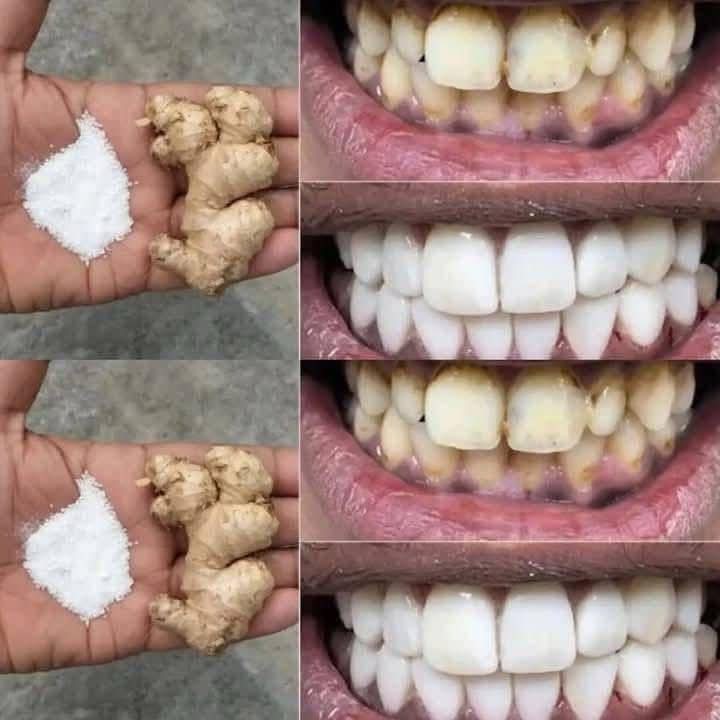 2 Minute Natural Teeth Whitening Treatment with Ginger And Salt